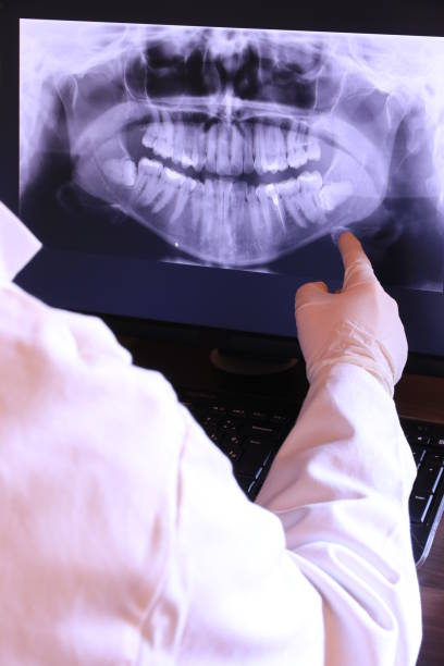 Best Emergency Dental Care for Broken or Chipped Teeth in China, TX